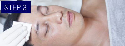 あごひげ脱毛Step3