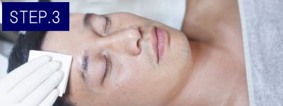 鼻下ヒゲ脱毛Step3