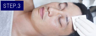 首ひげ脱毛Step3