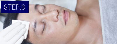 口下ヒゲ脱毛Step3