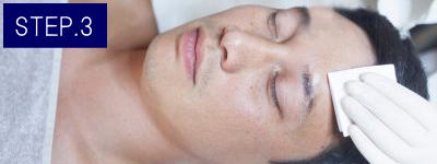 足の甲脱毛Step3