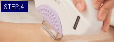 足の甲脱毛Step4