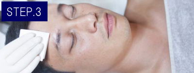 へそ周り脱毛Step3