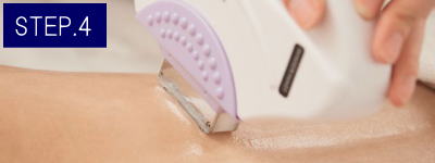 へそ周り脱毛Step4
