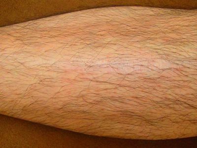 ひざ下脱毛Before