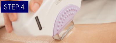 手の指脱毛Step4