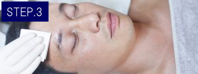 手の甲脱毛Step3