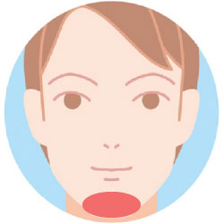 あごヒゲ脱毛の範囲