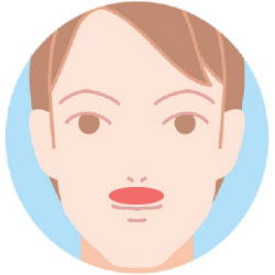 鼻下ヒゲ脱毛の範囲