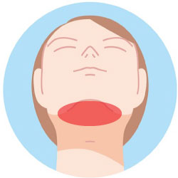 あご裏ヒゲ脱毛の範囲