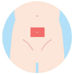 へそ周り脱毛の範囲