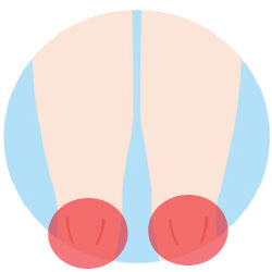 ひざ頭脱毛の範囲