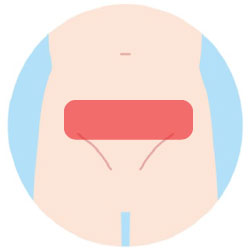 腹毛脱毛の範囲