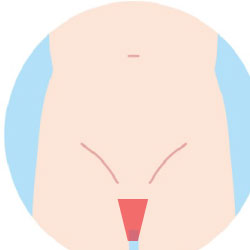 男性器の脱毛範囲