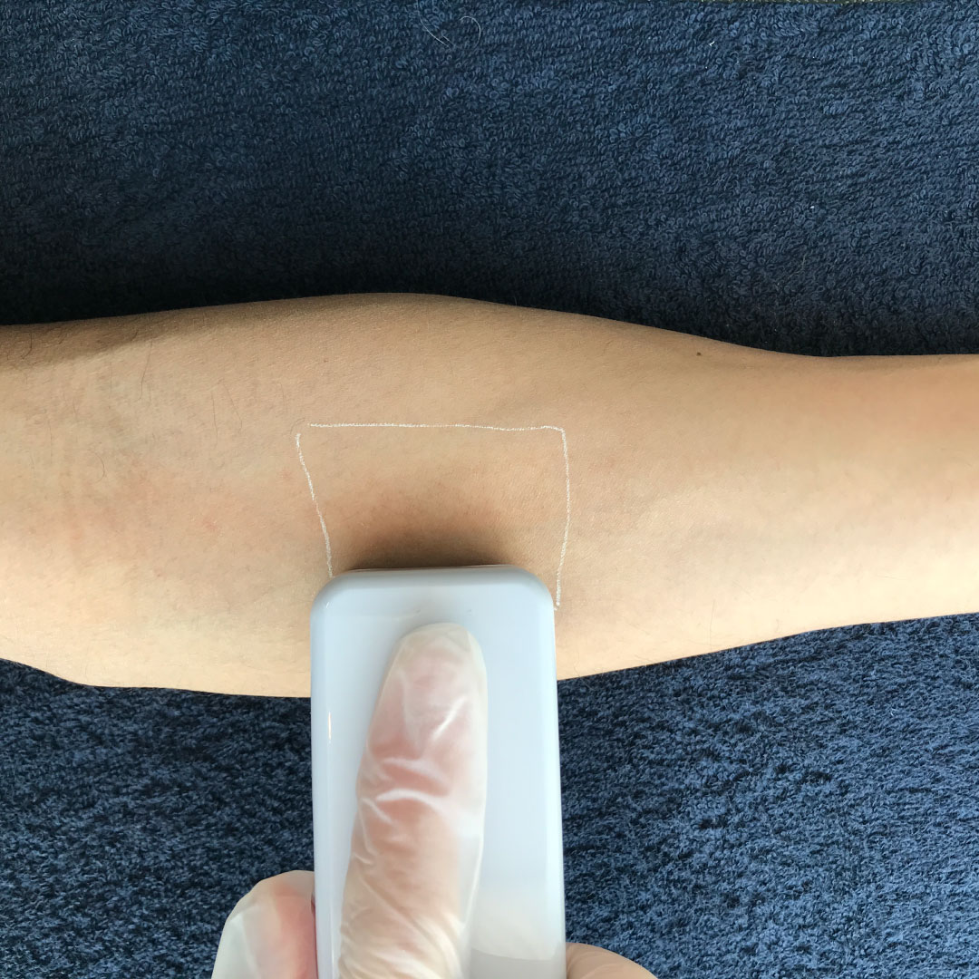 無料パッチテスト